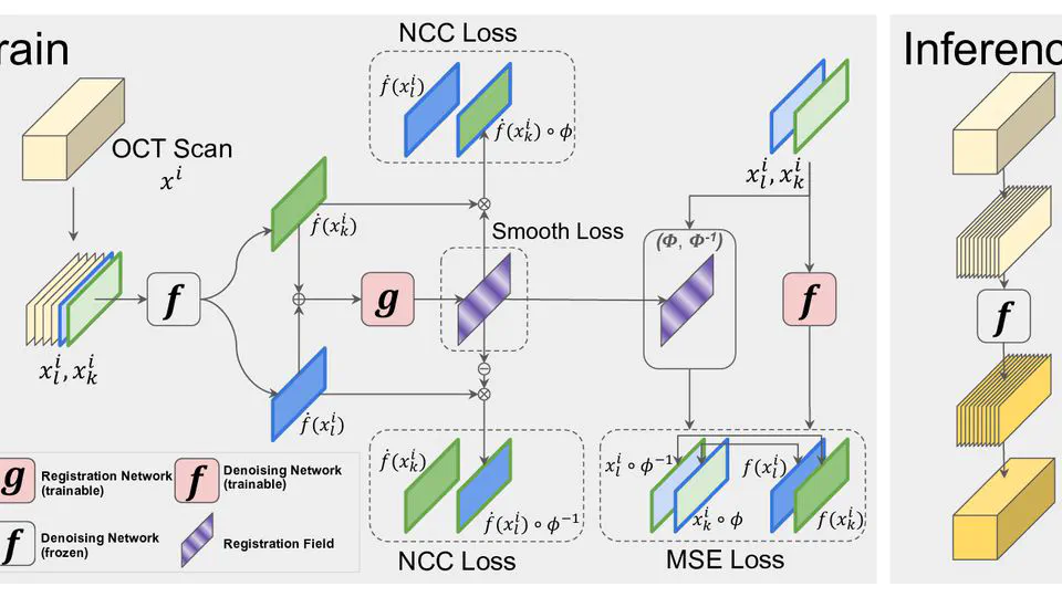 Self-supervised OCT image denoising with slice-to-slice registration and reconstruction